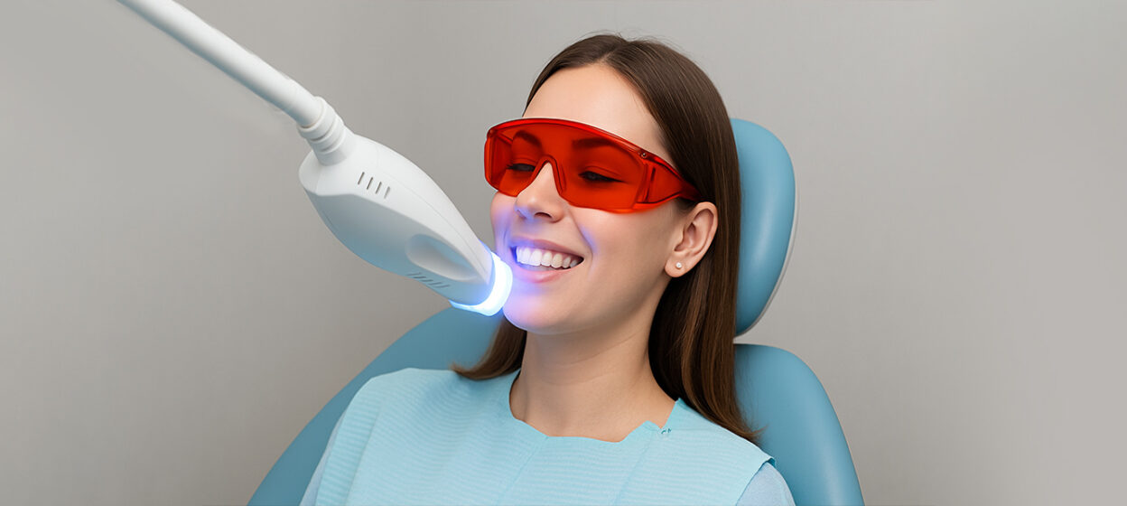 What Are the Advantages of Having Professional Teeth Whitening?