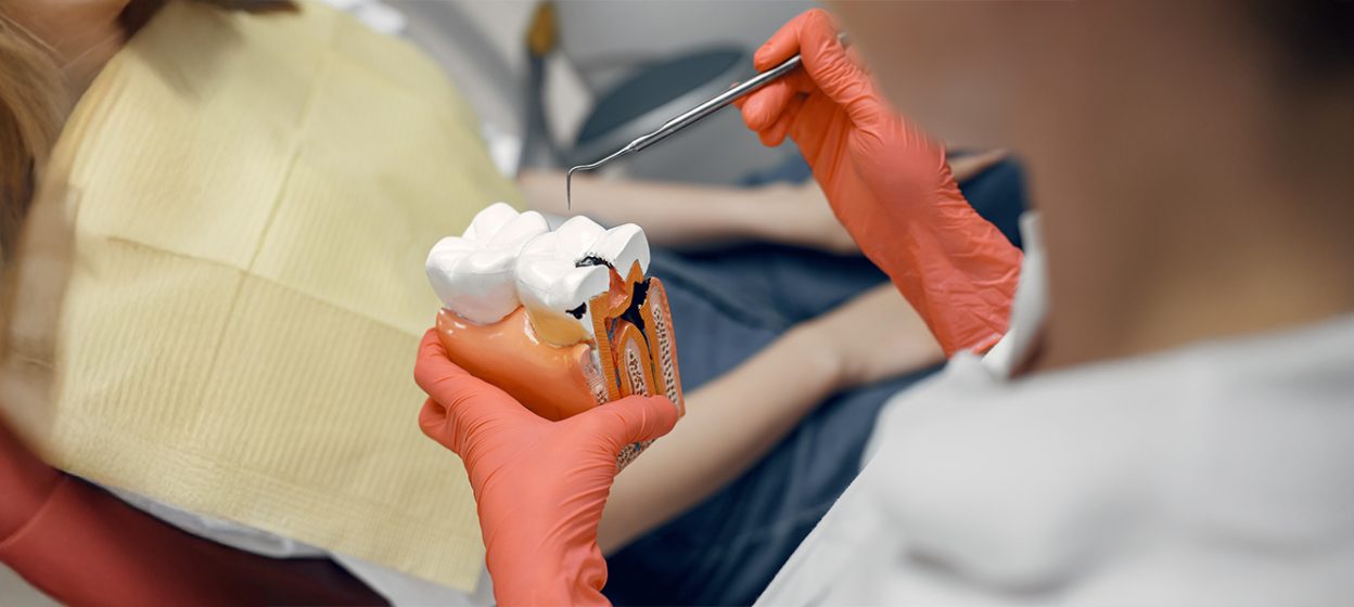 How Root Canals Relieve Severe Tooth Pain Effectively?