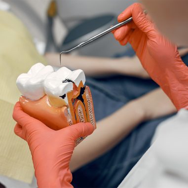 How Root Canals Relieve Severe Tooth Pain Effectively