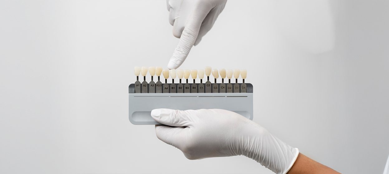 What Makes Veneers a Popular Cosmetic Dentistry Option?