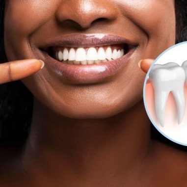 Restore Your Smile with Dental Implants in Bradford