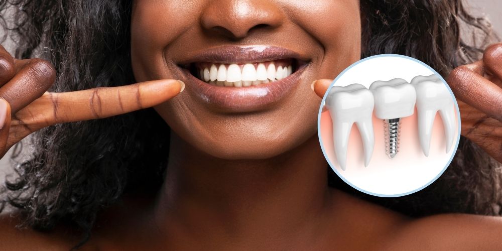 Restore Your Smile with Dental Implants